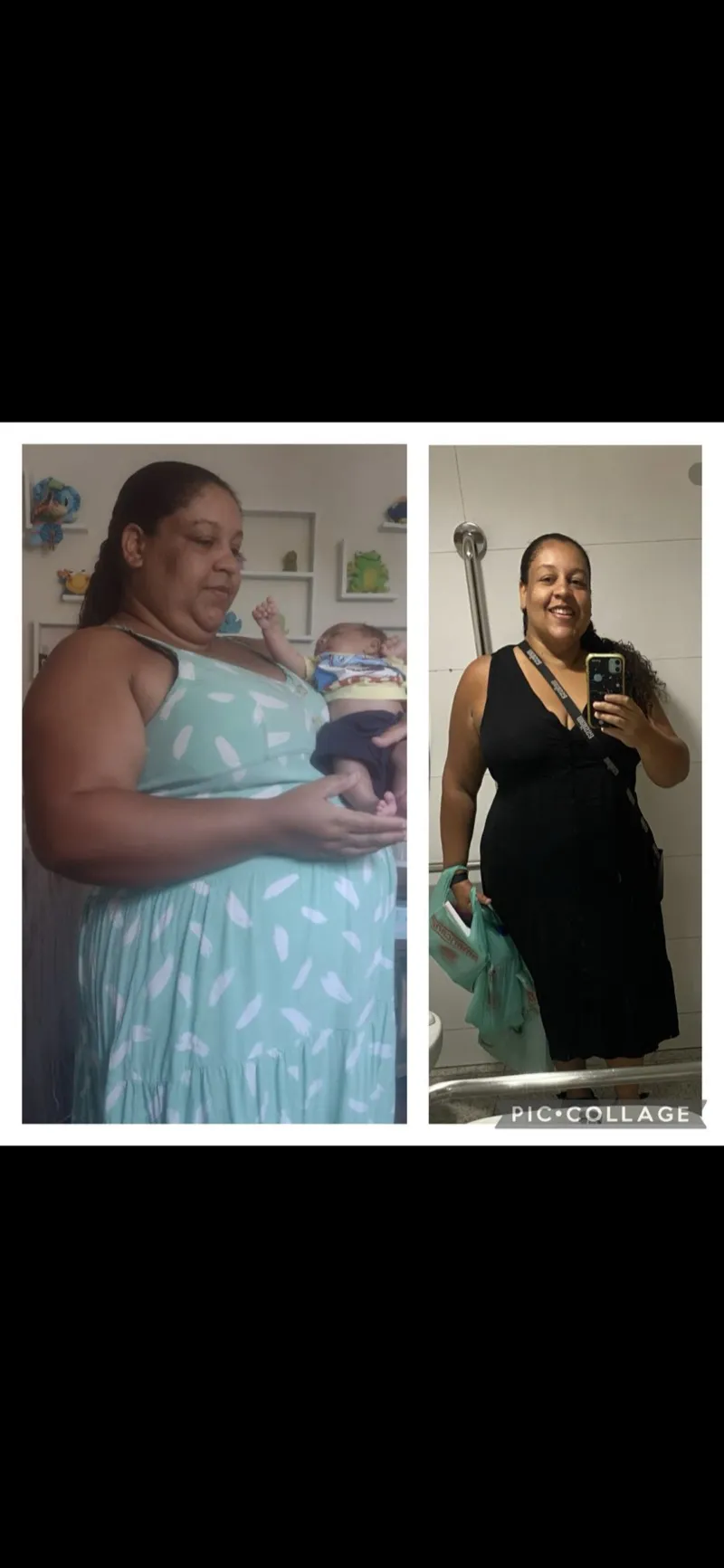 Antes e depois de paciente do Pedro Dias