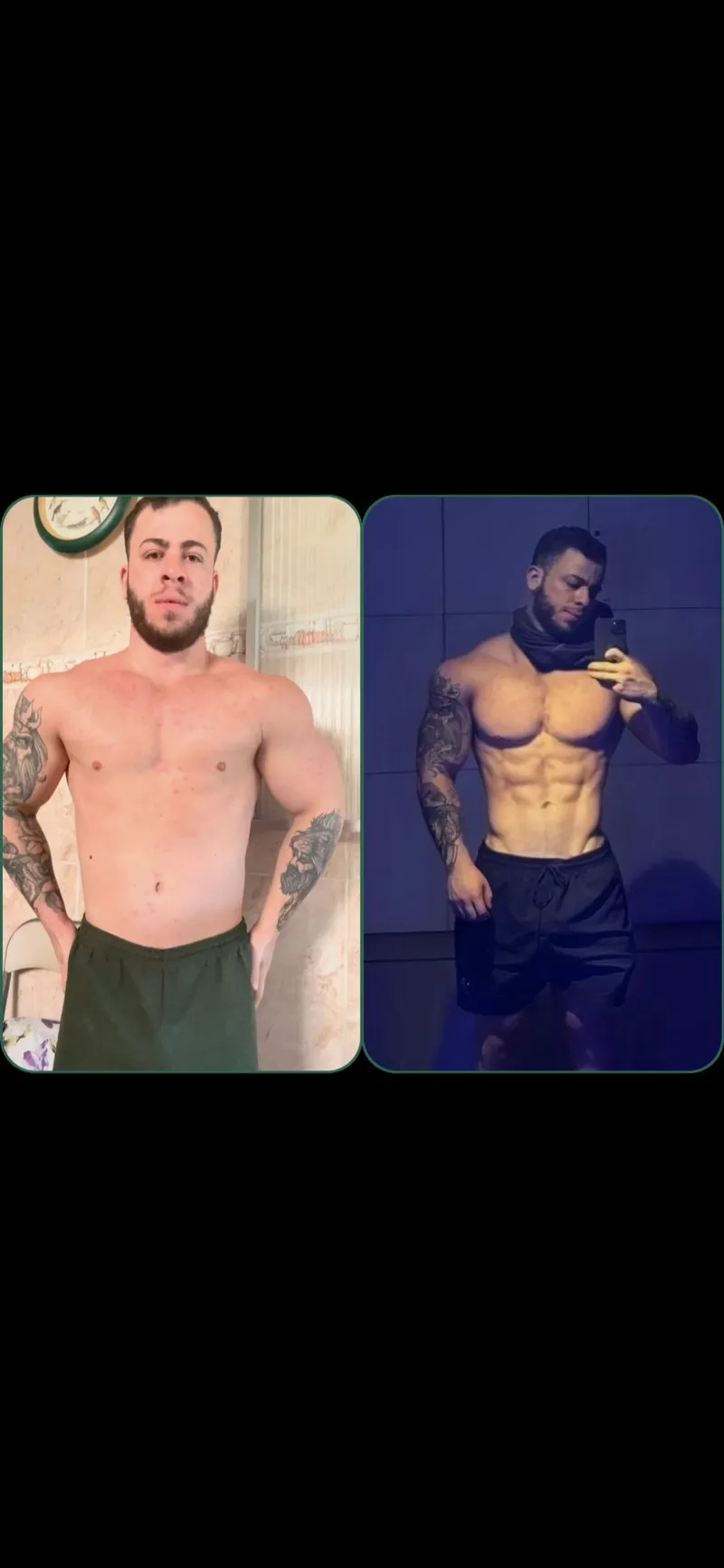 Antes e depois de paciente do Pedro Dias