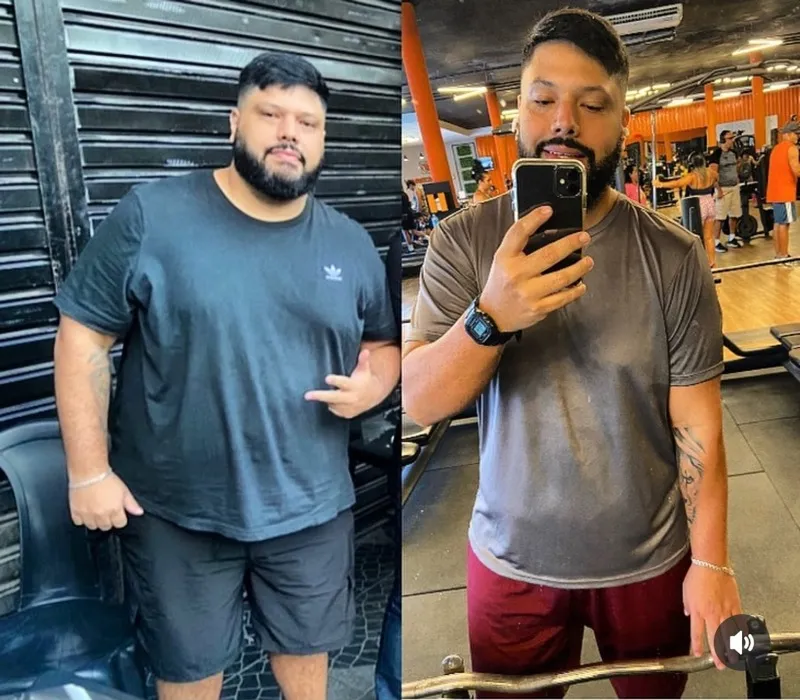 Antes e depois de paciente do Pedro Dias