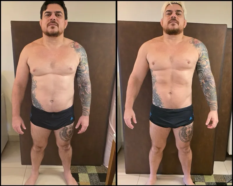 Antes e depois de paciente do Pedro Dias