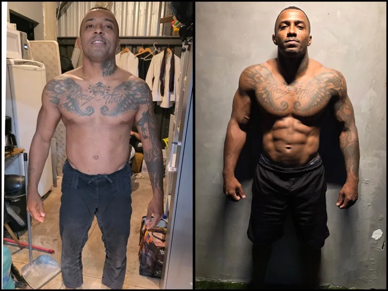 Antes e depois de paciente do Pedro Dias
